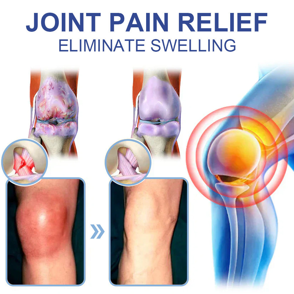 ✅HSE Approved: Ourlyard® Magnesium Pain Healing Bone Cream (Relief of neuropathy, muscle spasms, chronic pain, twitches or cramps, poor bone health and other arthritis)