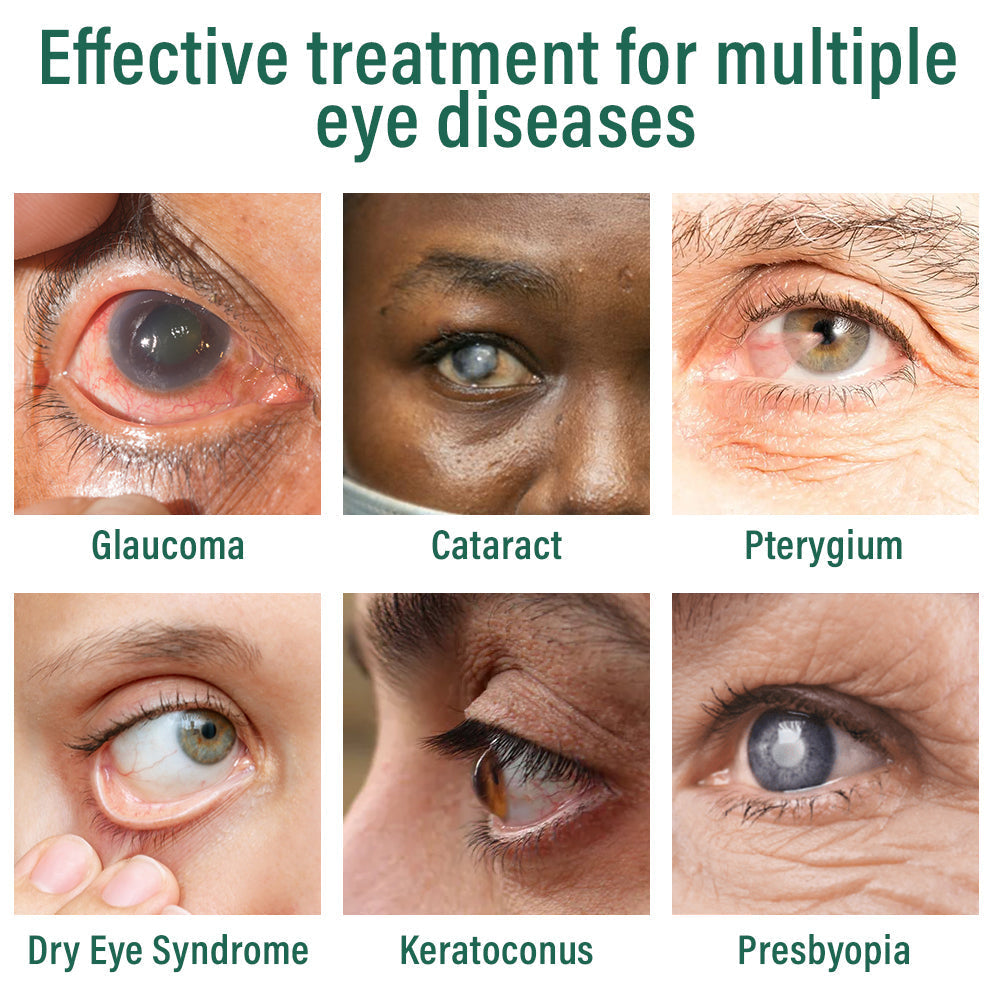 ✅ Ourlyard® Nano Eye Drops Serum 👩⚕️ Irish College of Ophthalmologists Recommended (Suitable for presbyopia, dry eye syndrome, glaucoma, and cataracts)