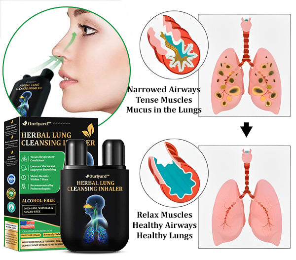 💞✅Officially certified import:Ourlyard™ Herbal Lung Cleansing Inhaler👨⚕️ (💝Quick results: Cough, wheezing, shortness of breath, sputum, stuffy nose, bronchitis, bronchitis, allergy symptoms, lung discomfort💝)