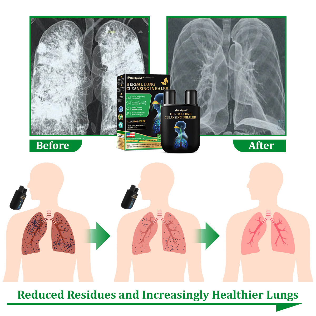 💞✅Officially certified import:Ourlyard™ Herbal Lung Cleansing Inhaler👨⚕️ (💝Quick results: Cough, wheezing, shortness of breath, sputum, stuffy nose, bronchitis, bronchitis, allergy symptoms, lung discomfort💝)