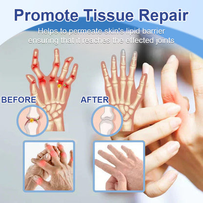✅HSE Approved: Ourlyard® Magnesium Pain Healing Bone Cream (Relief of neuropathy, muscle spasms, chronic pain, twitches or cramps, poor bone health and other arthritis)